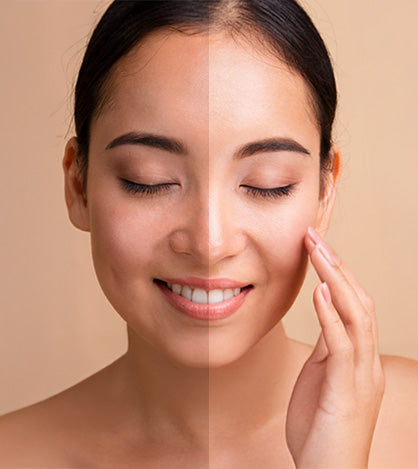 How to Remove Tan from Face Naturally at Home: Easy and Effective Remedies